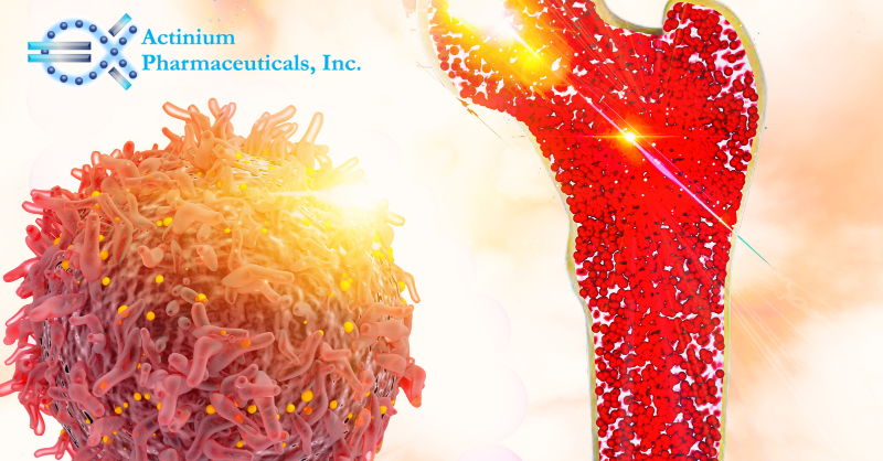 ActiniumPharma's tweet photo. Actinium is focused on the development of targeted radiotherapies. Learn more about new data from our HER3 targeting radiotherapy program as well as our novel strategy utilizing Actimab-A to deplete MDSCs by visiting our abstracts ahead of #AACR23: https://t.co/xg27ybHjSq $ATNM