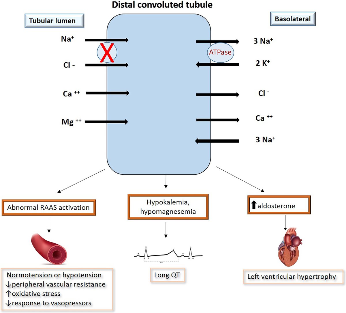 RCMjournal's tweet image. #RCM Special Issue-Sudden Cardiac Death in Special Population (3/5)

🚦The Impact of Gitelman Syndrome on Cardiovascular Disease: From Physiopathology to Clinical Management
from @saveriomuscoli et al.

#GitelmanSyndrome #SCD #CVD #RAAS #cardiovascular

🔎
imrpress.com/journal/RCM/23…