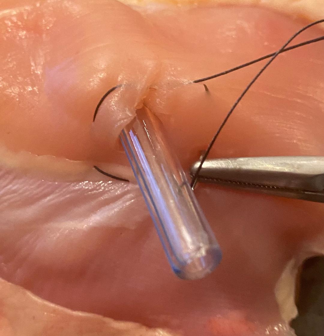 🧵regarding the 'figure-of eight' suture and also the 'pursestring' suture. We'll go over what they are for, some technical pointers, and errors that can be made while doing them. (1/ )