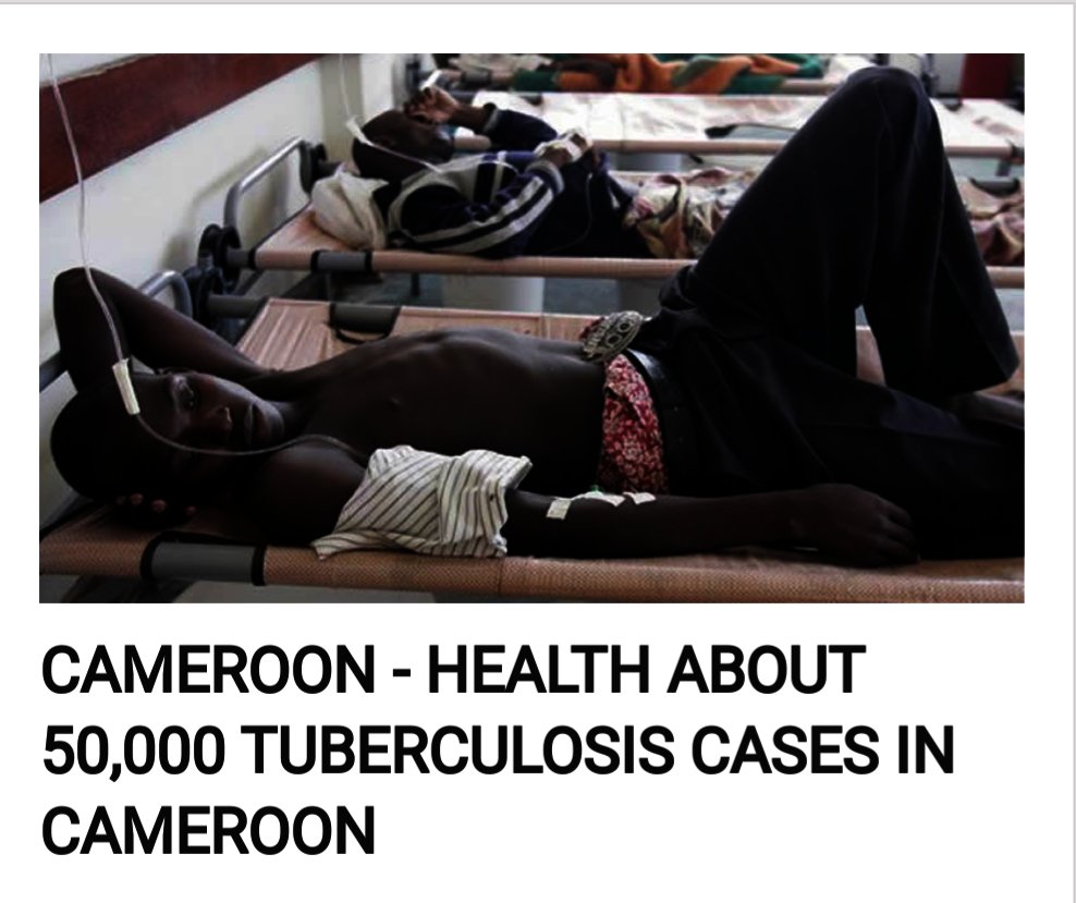COMERES2190261's tweet photo. Urgent Aid of 25000 Tuberculosis patients in kumba
ID: 59281

Link: https://t.co/EqLIjkgc2Q Short link: https://t.co/yc0HB3S2UI

Urgent medical aid ⛑️⛑️ 
Fundraise our cause through GlobalGiving by using the above link to the cause page, thank you https://t.co/dzdnms4yLy