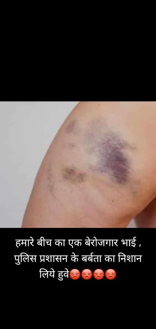 kewalramsa59713's tweet photo. @topchandnews @var_sha043 @bhupeshbaghel @ChhattisgarhCMO @DPRChhattisgarh @BJP4CGState @drramansingh @Chandrakar_Ajay @RajeshMunat @ArunSao3 @narayan_chandel https://t.co/aSGBLxjdXE