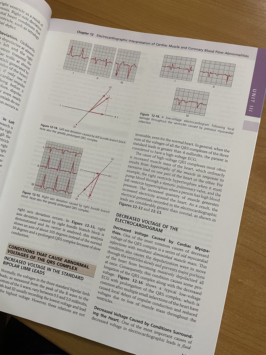 boynglassjar's tweet photo. 📚Guyton and Hall physiology ปกแข็ง เขียนไป 5 หน้าเองงับ 
💸 ส่งต่อ 3,000 บาทรวมส่ง (ราคาปกติ 3,900 บาท)
#หนังสือมือสอง  #หนังสือเตรียมสอบ #ส่งต่อหนังสือ #ส่งต่อหนังสือมือสอง #ส่งต่อหนังสือสภาพดี #ตำราแพทย์ #หนังสือแพทย์ #เตรียมสอบหมอ #ขายหนังสือ #medicine #textbook #guyton https://t.co/rhVm22yjik
