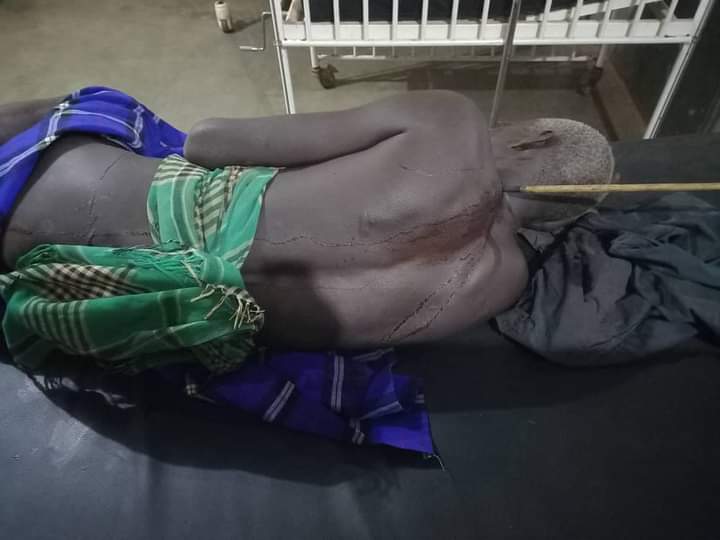Asiyo_Rutoman (@asiyo_lazarus) on Twitter photo Results of insecurity in Karamoja. Who is to blame?
<a href="/nbstv/">NBS Television</a> <a href="/ntvuganda/">NTV UGANDA</a> <a href="/ubctvuganda/">UBC UGANDA</a> Results of insecurity in Karamoja. Who is to blame?
<a href="/nbstv/">NBS Television</a> <a href="/ntvuganda/">NTV UGANDA</a> <a href="/ubctvuganda/">UBC UGANDA</a>