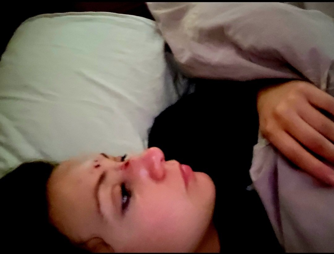 Ended up with the roles reversed and being the patient in ED last night. 🤕

It makes me slightly uneasy since I have raised ICP anyway but it probably needn't.