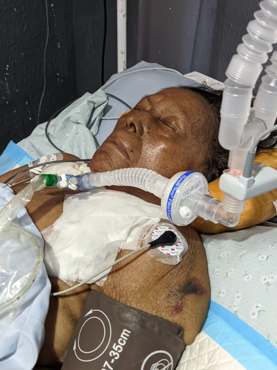 SegoviaArgueta's tweet photo. Señor presidente ayudeme a qué se haga justicia. Una mala praxis dejo así a mi madre y en dicho hospital privado sucede muy a menudo tuve que vendér locales y la casa donde vivía con mi madre para aún así pagar 104 mil $ y una factura no me han dado porque dicen que aún les debo. https://t.co/CS4VnsmOiR