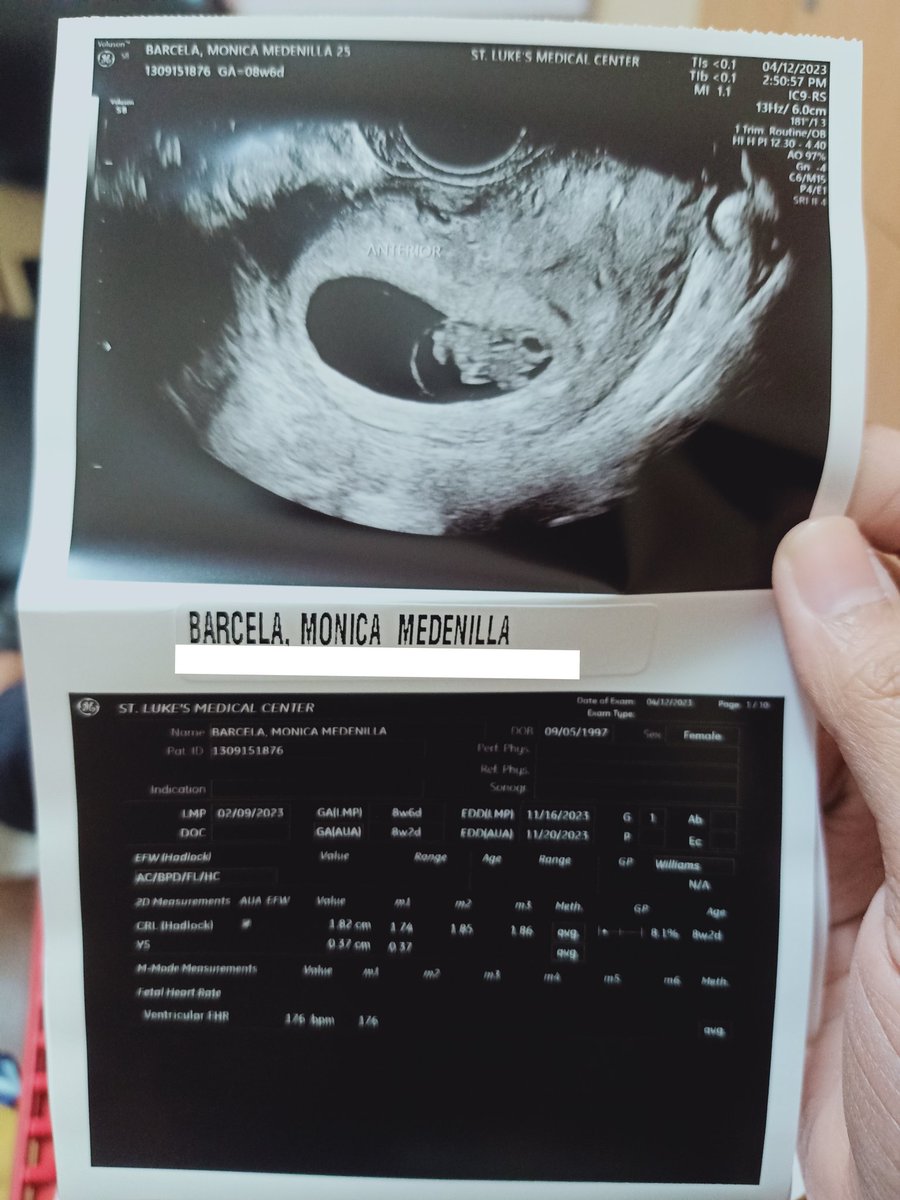 Nhikaaaaaay's tweet photo. "Welcoming our little one on (November 2023)." 👶🥰💖💝💞
#9weekspregnant #TeamNovember https://t.co/geKvhUkpMT