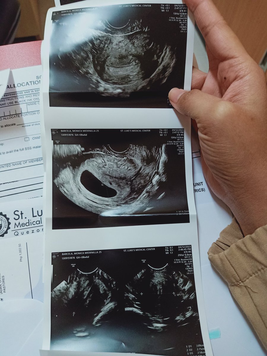 Nhikaaaaaay's tweet photo. "Welcoming our little one on (November 2023)." 👶🥰💖💝💞
#9weekspregnant #TeamNovember https://t.co/geKvhUkpMT