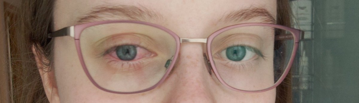 zUnverdient | Finja tweet media