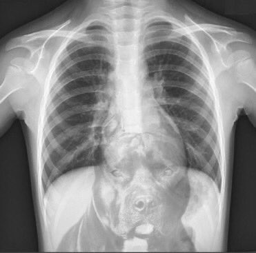 If this is what your X-ray looks like, come be a member of the 2023 Athens Drive High school football team.