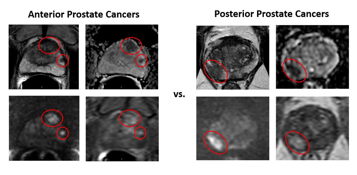 Baris Turkbey MD tweet media