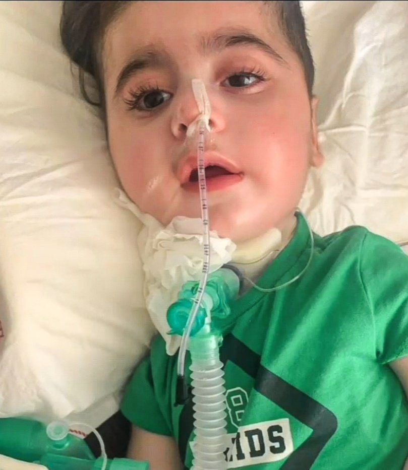 smaumudanefesol's tweet photo. Umut çaresizlik içinde sizden gelecek yardım elini bekliyor, direniyor.
Nefes alabilmek, hayatta kalmak için mücedele ediyor. 
Lütfen az çok demeden destek olun.Umutun ellerini bırakmayın🙏����
#BeşiktaşınMaçıVar Oğuzhan Uğur Saka #pazar @HazalKaya110 #MemurBayramEtsin #KadirGecesi https://t.co/4b8Fv6ivqG