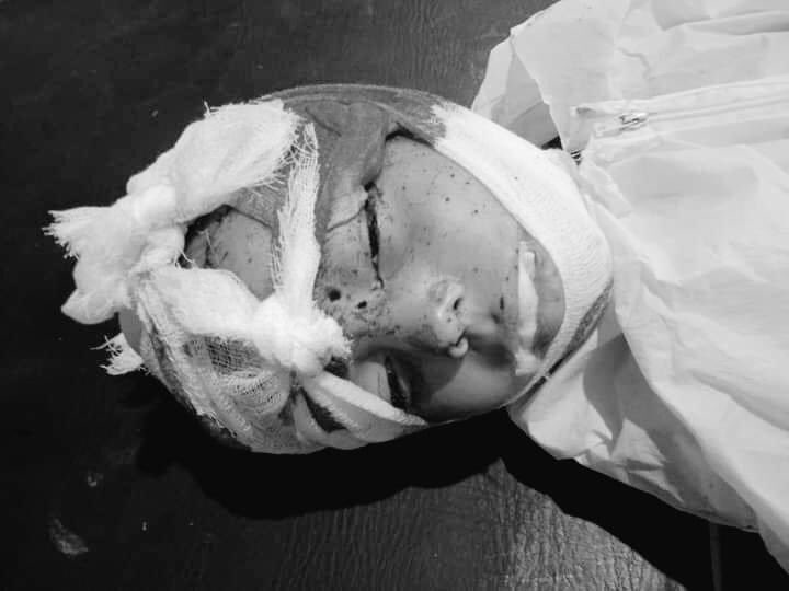 NaimatUllahWazi's tweet photo. Another Pashtun 11 years old child #SherAli son of Sherangal martyred in a landmine blast planted by Pak army in Sararogha Waziristan.
One of the main demands of PTM is to #DemineExFATA
@ManzoorPashteen https://t.co/PrdQsmLARV