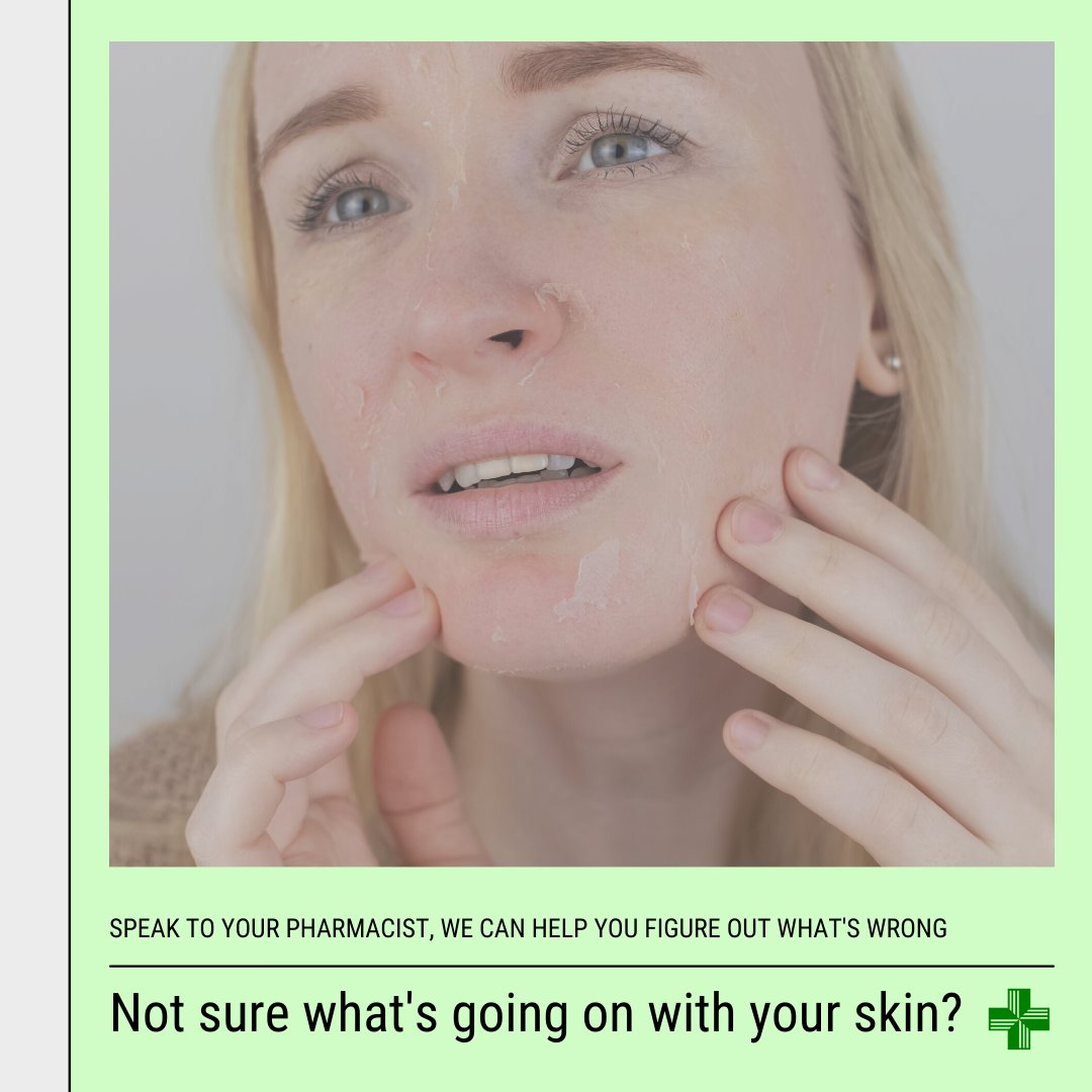 eastfieldpharm's tweet photo. Dry, flakey skin? We can help with that! https://t.co/hEtwNL75S9