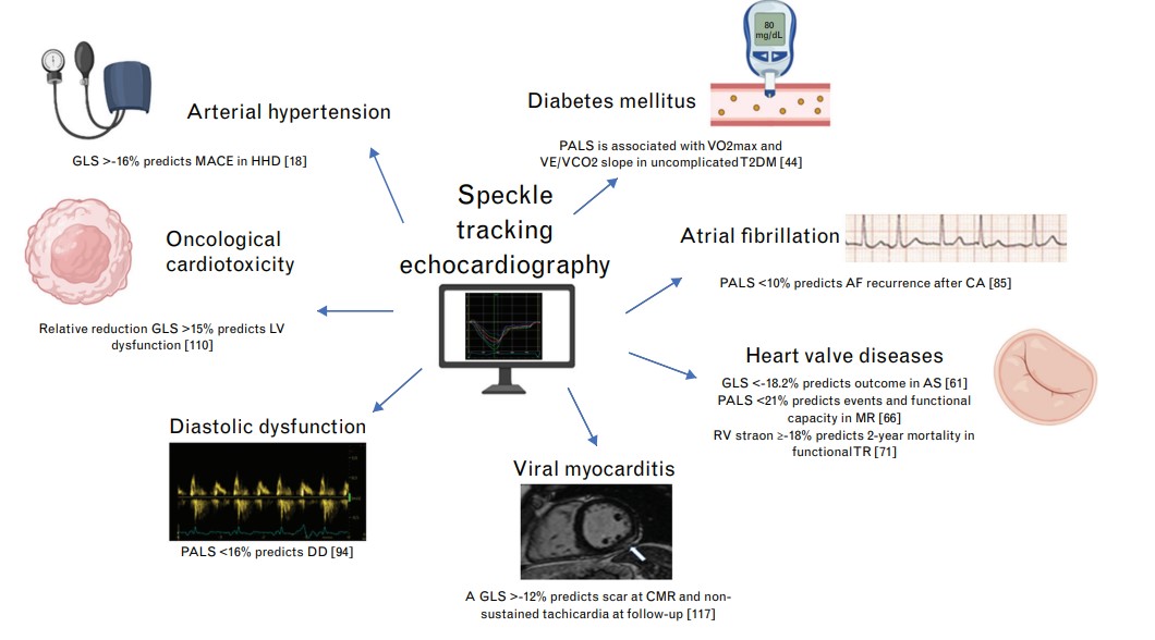 Giulia Elena Mandoli, MD, PhD, FESC, FISC (@drgemandoli) on Twitter photo 🎯 Happy to share our new #review by <a href="/SIC_CARDIOLOGIA/">SIC Società Italiana di Cardiologia</a> #echocardiography WG about the role of echo in early-stage diseases 🫀
pubmed.ncbi.nlm.nih.gov/37052222/
#hypertension #myocarditis #afib
<a href="/Matte_Cameli/">Matteo Cameli, MD, PhD</a> <a href="/MC_Pastore/">Maria Concetta Pastore</a> <a href="/GiovanniBenfari/">Giovanni Benfari</a> <a href="/antondandr/">Antonello D'Andrea</a> <a href="/S_Sperlongano/">Simona Sperlongano</a> <a href="/CiroSantoro17/">Ciro Santoro</a> <a href="/IndolfiCiro/">Prof. Ciro Indolfi</a> 🎯 Happy to share our new #review by <a href="/SIC_CARDIOLOGIA/">SIC Società Italiana di Cardiologia</a> #echocardiography WG about the role of echo in early-stage diseases 🫀
pubmed.ncbi.nlm.nih.gov/37052222/
#hypertension #myocarditis #afib
<a href="/Matte_Cameli/">Matteo Cameli, MD, PhD</a> <a href="/MC_Pastore/">Maria Concetta Pastore</a> <a href="/GiovanniBenfari/">Giovanni Benfari</a> <a href="/antondandr/">Antonello D'Andrea</a> <a href="/S_Sperlongano/">Simona Sperlongano</a> <a href="/CiroSantoro17/">Ciro Santoro</a> <a href="/IndolfiCiro/">Prof. Ciro Indolfi</a>