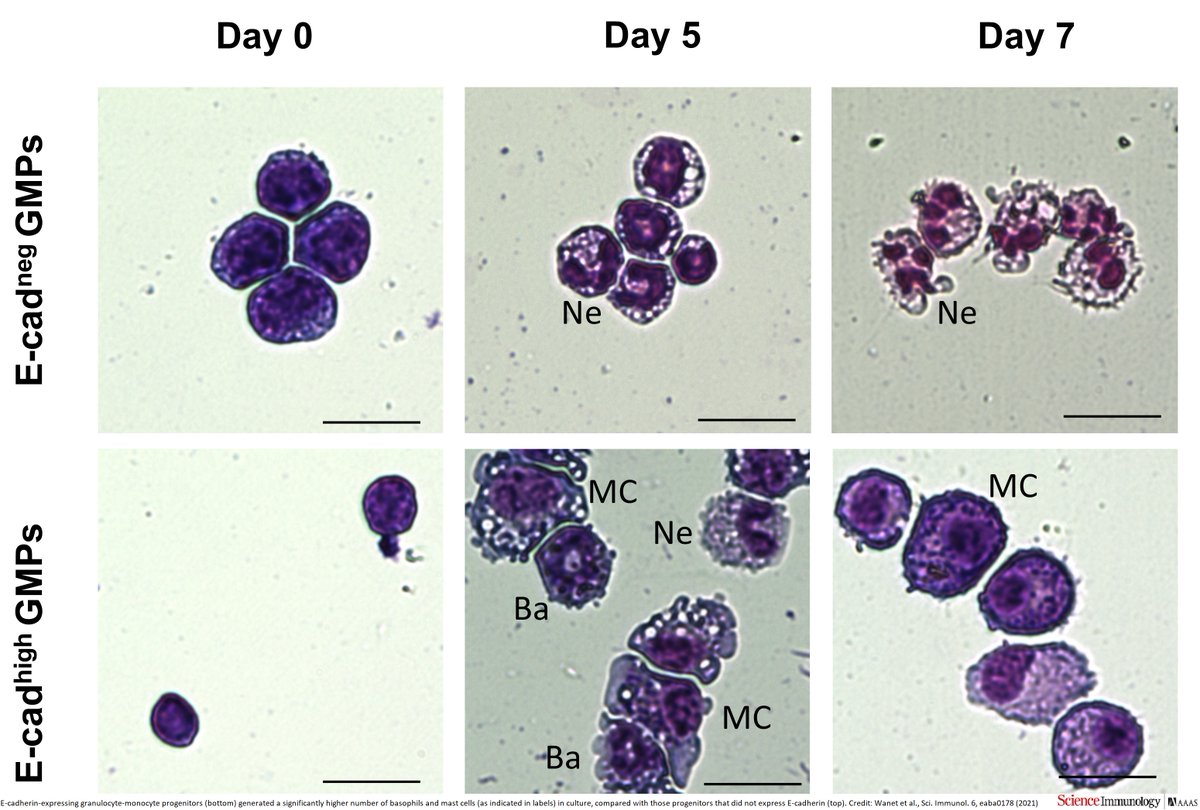 Science Immunology (@sciimmunology) on Twitter photo A 2021 study elucidates the origins of basophils and mast cells, white blood cells primarily known for their roles in #allergy and #anaphylaxis.
Learn more: scim.ag/2gg <a href="/harvardstemcell/">HSCI</a> <a href="/uabmedicine/">UAB Medicine</a> <a href="/csi_singapore/">CSI Singapore</a> A 2021 study elucidates the origins of basophils and mast cells, white blood cells primarily known for their roles in #allergy and #anaphylaxis.
Learn more: scim.ag/2gg <a href="/harvardstemcell/">HSCI</a> <a href="/uabmedicine/">UAB Medicine</a> <a href="/csi_singapore/">CSI Singapore</a>