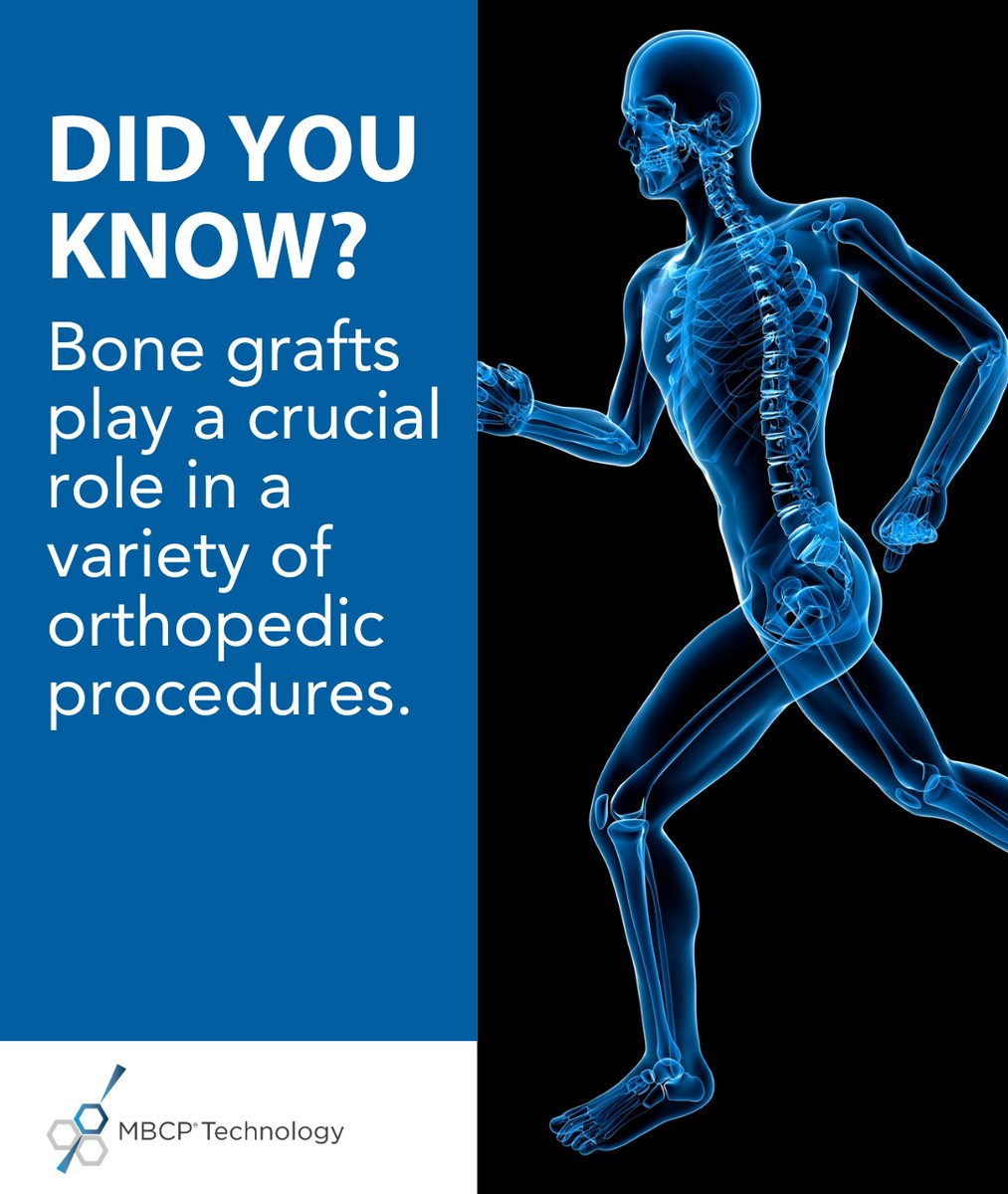 #Bonegrafts play a crucial role in a variety of #orthopedic procedures, from spinal fusions to reconstructive surgeries. By supplementing the body's natural healing process, bone grafts can help to stabilize fractures, correct deformities, &amp; promote new bone tissue growth.