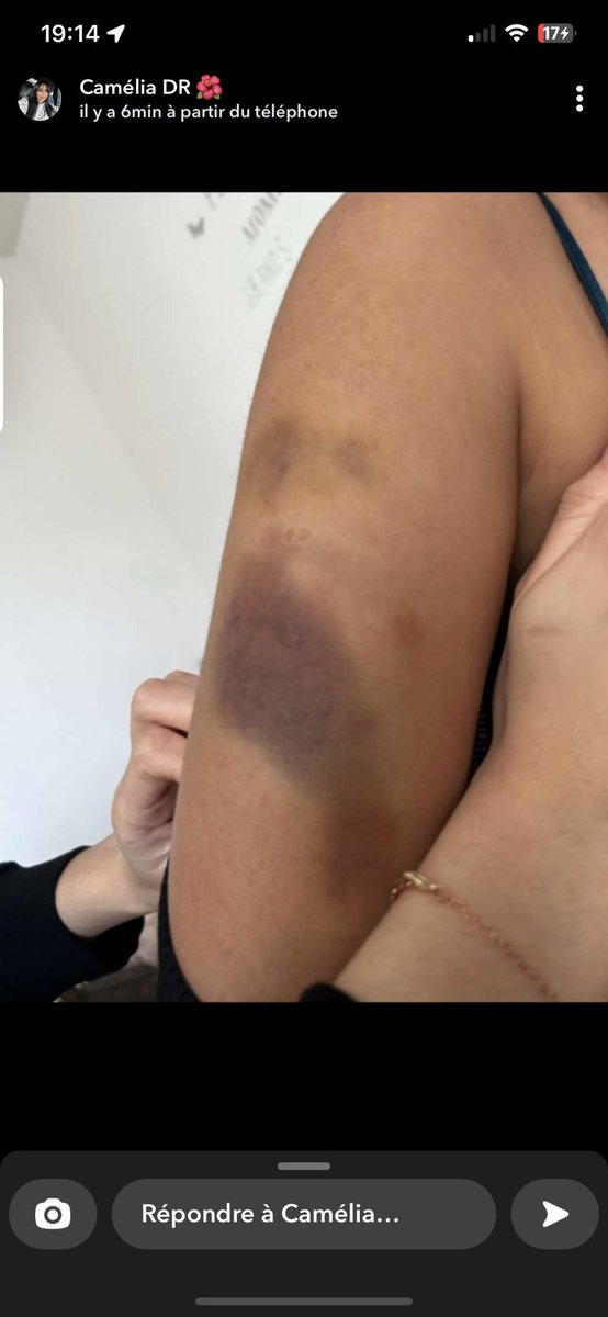 Nessouu_31's tweet photo. Il n’y a aucune justification pour frapper une femme. La violence est inacceptable et ne peut jamais être justifiée, peu importe ce qui se passe dans un couple.Les relations doivent être basées sur le respect et la communication, #camelia_dr https://t.co/ngHckJaCXm