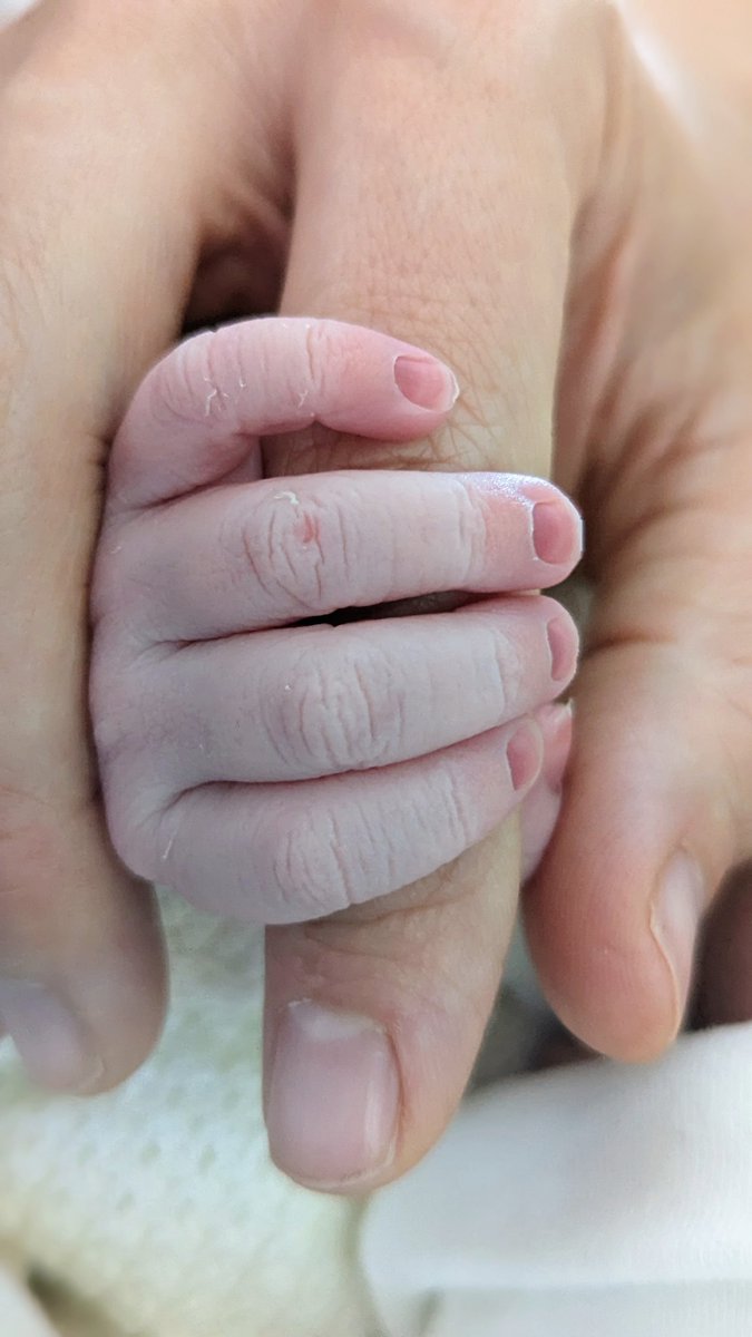 Hugo Figueiredo tweet media