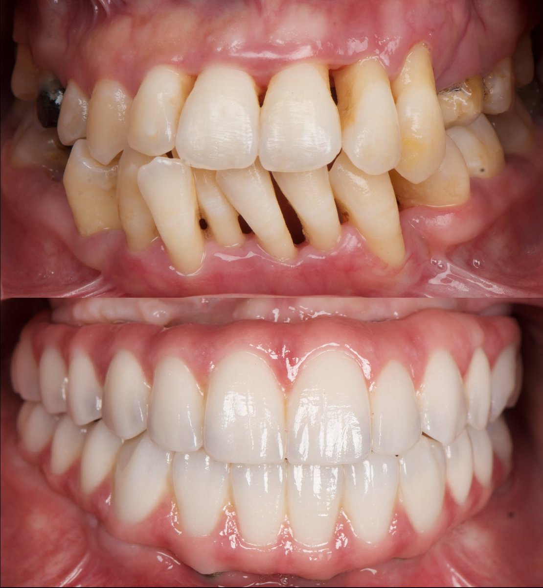 Before and after 
<a href="/dentalhousec/">Dental House Clinics</a>