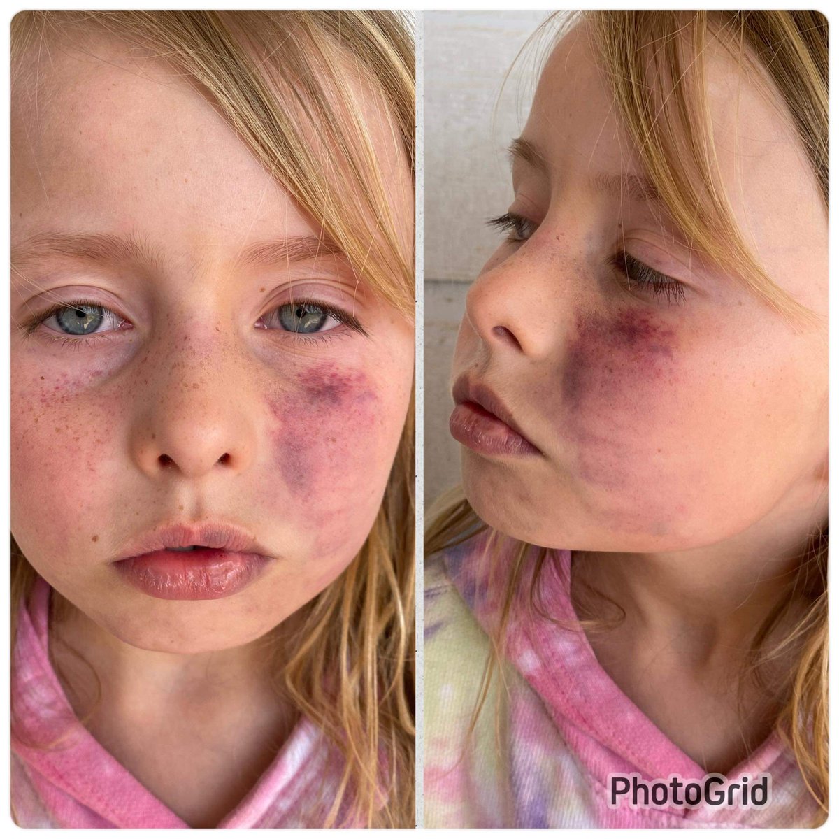 JusticeAdvocate's tweet photo. @OklahomaKids @Shers_Sparks @OklahomaWatch @OKDHS @Okla_OAG @mariashriver @kokonews @NewsOn6 @KTULNews
@OKCFOX @FOX23
 8 year old girl abused by her adoptive mother. No charges filed against adoptive mother yet. Wants to be returned to her biological family where she feels safe.
#JusticeForKinzly https://t.co/mzcUmY4fCq