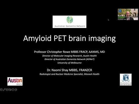 Amyloid PET brain imaging is a valuable diagnostic tool for detecting early signs of dementia, Alzheimer's disease and MCI. In this 2 part series, Prof Chris Rowe explains appropriate use of amyloid PET, how to read scans &amp; accurately interpret results buff.ly/3UB2Vjx