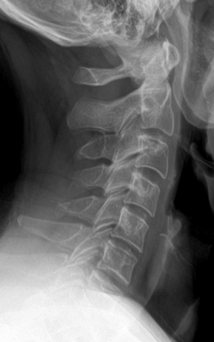 M. Skalski tweet media