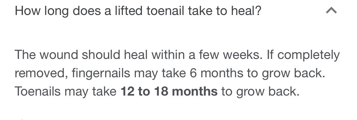 FiffanyLuu's tweet photo. Press on toenails it is 🥲 https://t.co/uo0wmPc8Zn