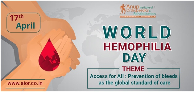 World Hemophilia Day

#worldhemophiliaday #worldhemophiliaday2023 #worldhemophilia #hemophiliaday #orthopaedicsurgeon #orthopaedicdoctor #drrnsingh #bonedoctor #drashishsingh #hipreplacement #makoroboticsurgery #roboticjointreplacement #orthopaedichospital #jointreplacement