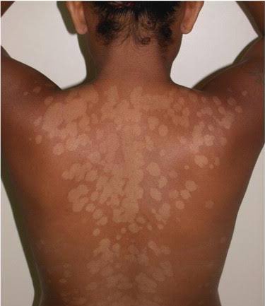 Doctors, what causes this?