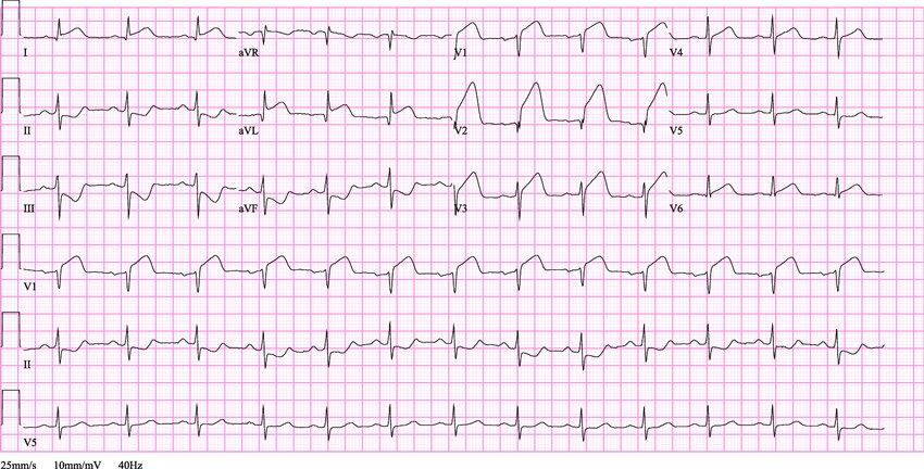 Dr. Karen Miley DNP, LPN, LVN, CCN, ESP, RBF, ROFL tweet media