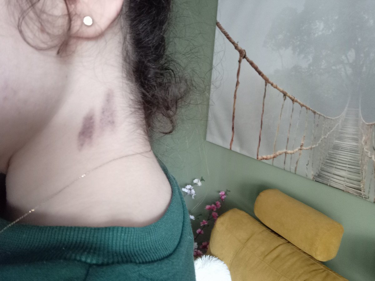 curlygom0301's tweet photo. Mama: CZY ON CHCĘ CI WYSSAĆ TĘTNICĘ?! https://t.co/EJEyIuPlQT