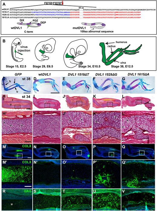 DMM_Journal's tweet photo. Joy Richman, @EstherVerheyen &amp; co show mutations affecting  DVL1 protein that is involved in #RobinowSyndrome, alter the balance of canonical and non-canonical #WntSignalling in the chicken limb and #Drosophila wing

📰https://t.co/qkxHPGtEFs
@ubclifesciences @SFU_Science https://t.co/mtlDYbYAbX
