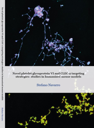 CARIMMaastricht's tweet photo. #thesisdefence tomorrow 13.00 hour Stefano Navarro will defend the thesis: 'Novel platelet glycoprotein VI and CLEC-2 targeting strategies: studies in humanized mouse models'

📺https://t.co/Dl4ZcF0iQW

#GPVI #phdlife #thrombosis

@NieswandtLab @MaastrichtU @StefanoNavarro8 https://t.co/uiyNCjRERw