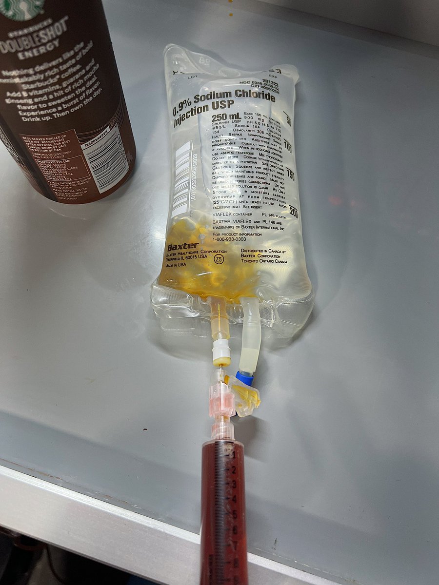 le_chadd's tweet photo. Thx to an unusually slow shift, I came up with a way for student to practice IVs w/out sacrificing any human limbs:

- draw up partners coffee
- insert into 250cc bag
- tape tubing to stretcher handle
- begin acupuncture/voodoo ritual

Bonus: IV bolus coffee when done 
(jk don't) https://t.co/2VFOzs7ynP
