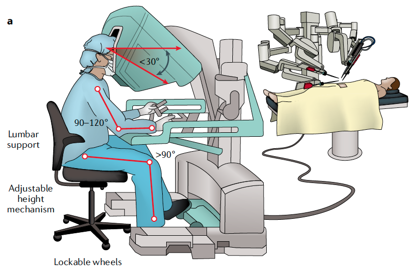 🚨 #SurgErgoTip: Robotic console arm position

Armrest should be adjusted to keep hands near elbow height

Frequent use of clutch control to keep hands in the center of working envelope with forearms on rest

fig c/o rdcu.be/c95Dn