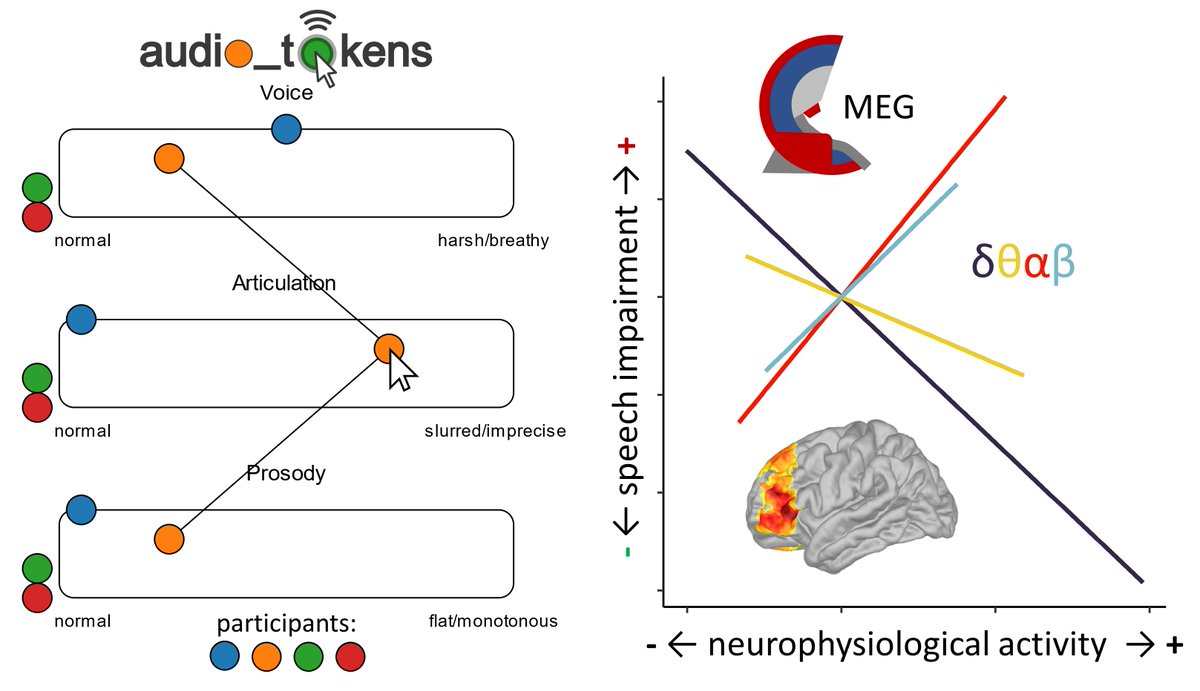 Did you know that patients with #Parkinson's disease often have trouble speaking clearly?🙊

These speech impairments affect communication of needs and social interaction

We identify the neurophys changes related to speech impairments in PD

nature.com/articles/s4153…

🧵👇
