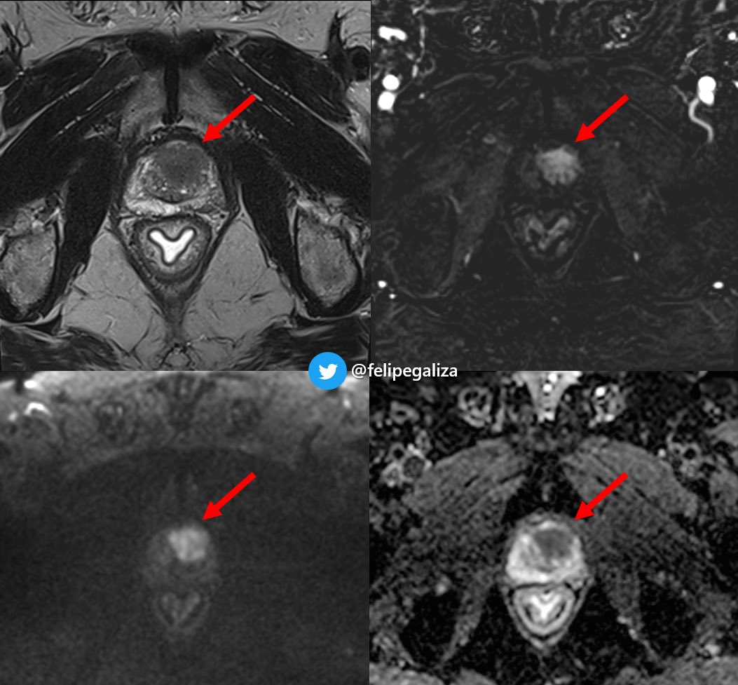 Felipe de Galiza tweet media