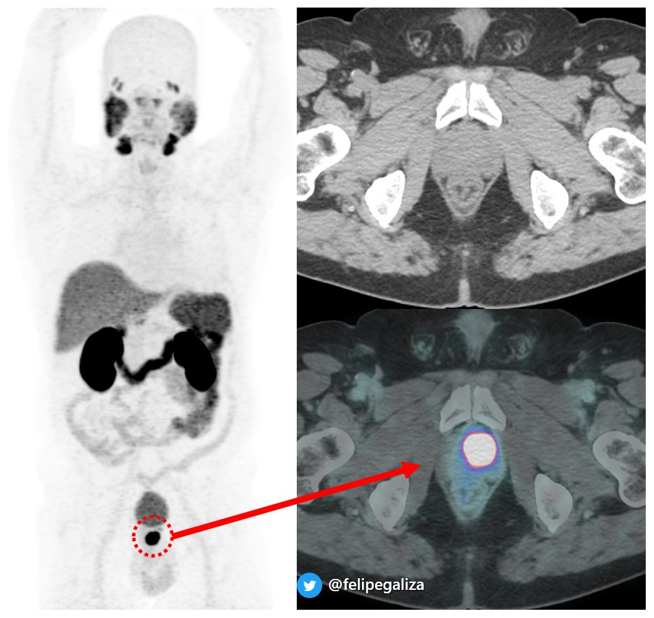 Felipe de Galiza tweet media