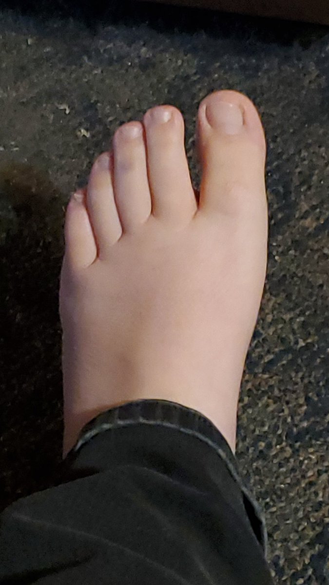 2_wildflower's tweet photo. Anyone wanna fund my pedicure? 

Findom femmedom paypig pretty feet https://t.co/DFMKiWp6Ex