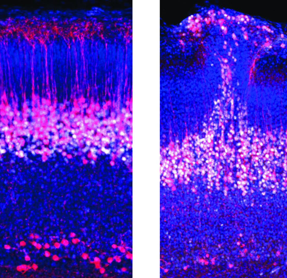 IOB.ch (@iob_ch) on Twitter photo Exciting new insights from the <a href="/IOB_Roska/">Botond Roska</a> lab into the formation of cortical circuits during embryonic development in <a href="/MartinMunz2/">Martin Munz</a> and <a href="/bharioke/">bharioke_neuro</a> new paper, out in <a href="/CellCellPress/">Cell</a> today: doi.org/10.1016/j.cell… Exciting new insights from the <a href="/IOB_Roska/">Botond Roska</a> lab into the formation of cortical circuits during embryonic development in <a href="/MartinMunz2/">Martin Munz</a> and <a href="/bharioke/">bharioke_neuro</a> new paper, out in <a href="/CellCellPress/">Cell</a> today: doi.org/10.1016/j.cell…