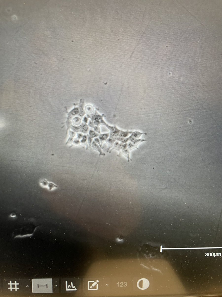 LuciaDiVagno's tweet photo. Am I the only one thinking that my cells look like an owl? 😅 https://t.co/MLv1INQjFE