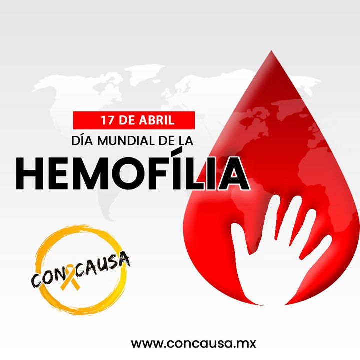 Hoy en el Día Mundial de la Hemofilia tomemos conciencia de la enfermedad y compartamos conocimientos para mejorar la calidad de vida de los que la padecen. #diamundialdelahemoflia
#DiaMundialHemofilia #HemophiliaAwareness #HemophiliaDay