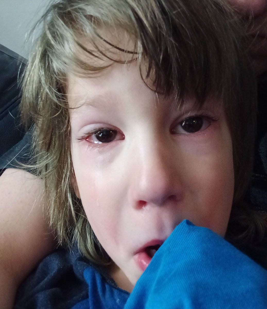 FormerAntivax's tweet photo. How dare @MartyMakary and the rest of the laptop class tell parents that covid is mild for children? #CovidIsntOver #covidisnotforkids #ventilateclassrooms #vaccinateyourkids #maskup #stayhomewhensick #testoften #slowthespread https://t.co/Wi5jQ6Vfed