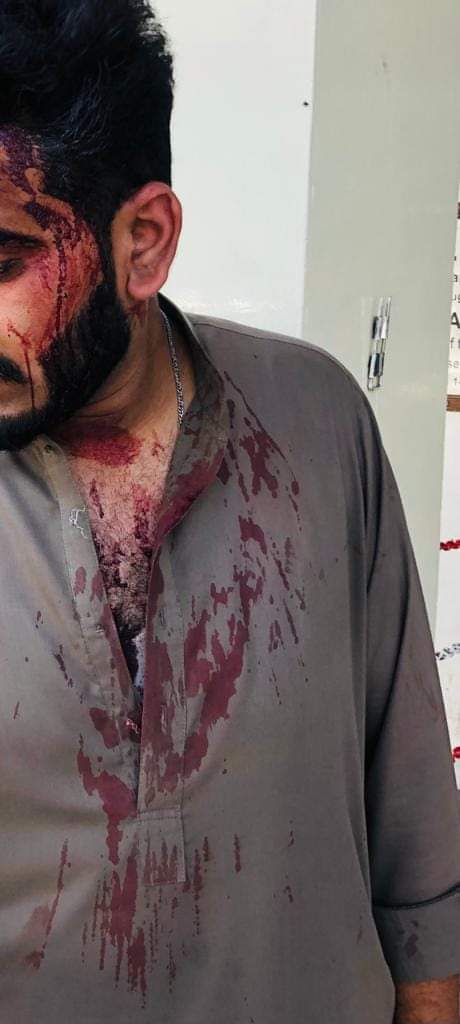 AhsansuraniBal1's tweet photo. وسیب دشمن ہر دستور
نامنظور نامنظور #Dirty_Politics_by_Arid_Admin
#ChangeDSA_saveArid
#savearid
#longliveSSC
#LongLiveResistance #ASF
#savearidstudentsfromDSA https://t.co/zVcTE9Xz34