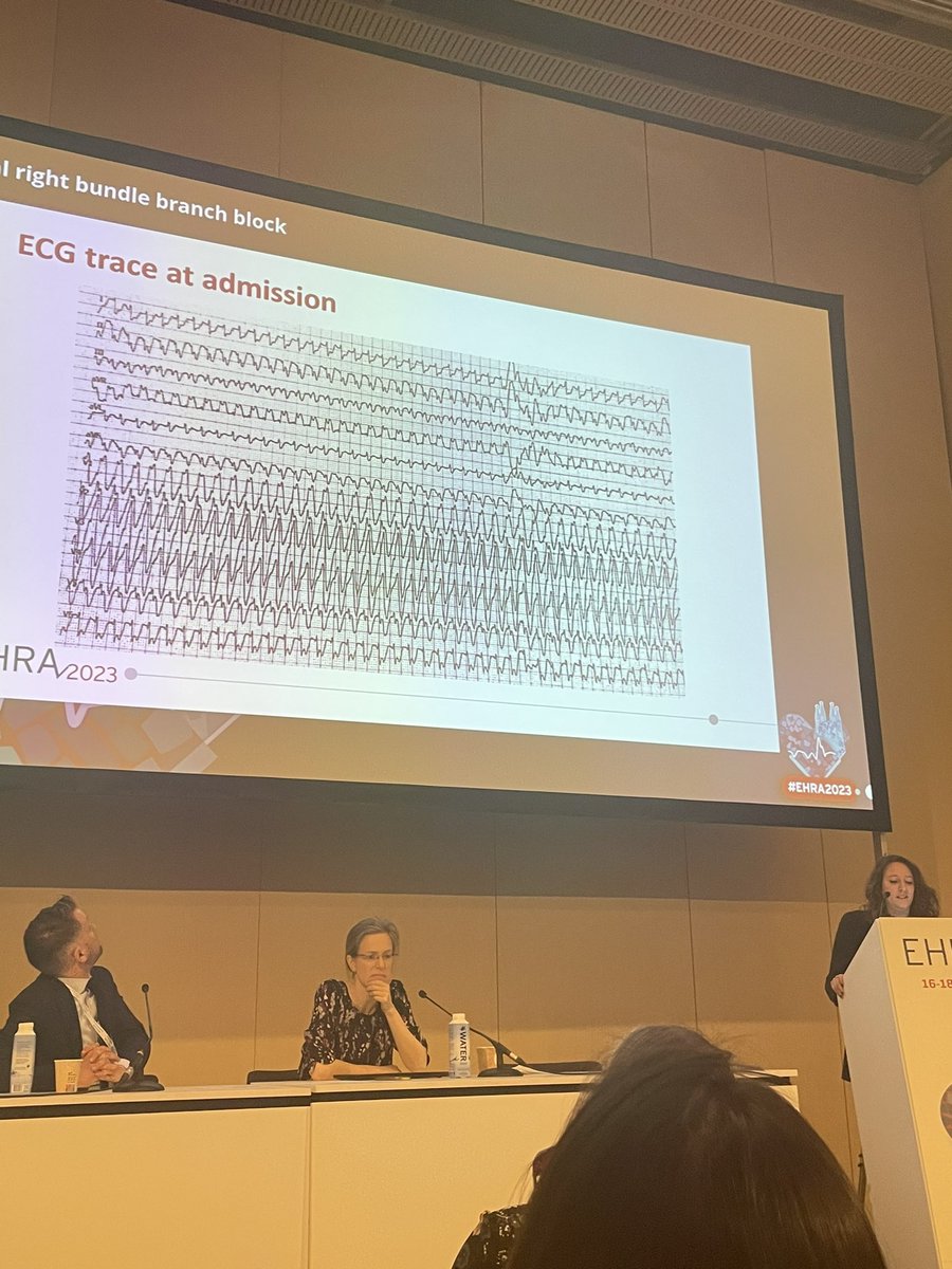 Francesco Vitali (@fra_vitali90) on Twitter photo #EHRA great ECG session today! Lots of difficult and rare ECGs!
Nice case of differential diagnosis for wide complex tachycardia from our EP fellow <a href="/MartinaRaffele/">Martina De Raffele</a> 👏👏👏👏 #EHRA great ECG session today! Lots of difficult and rare ECGs!
Nice case of differential diagnosis for wide complex tachycardia from our EP fellow <a href="/MartinaRaffele/">Martina De Raffele</a> 👏👏👏👏