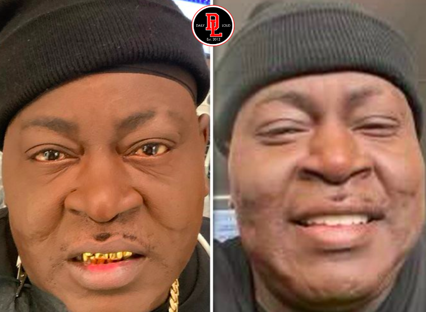 DailyLoud's tweet photo. Trick Daddy gets new $60,000 veneers &amp; his gold grills replaced after 30 years, he had not been to dentist in 15 years https://t.co/FIB2bhvpzf