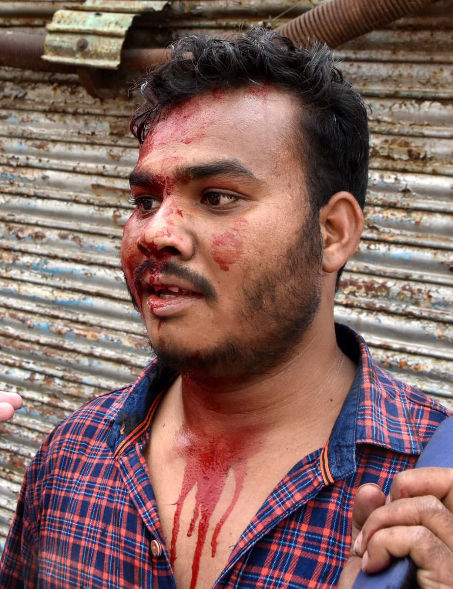 खून बहेगा झारखंडी का और नौकरी करेगा बाहरी 
लोग ,ऐसा नहीं चलेगा मुख्यमंत्री<a href="/HemantSorenJMM/">Hemant Soren</a> सर 

खून 🩸🩸 के  एक - एक कतरा का हिसाब देना होगा आपको साहब
#60_40_नाय_चलतो