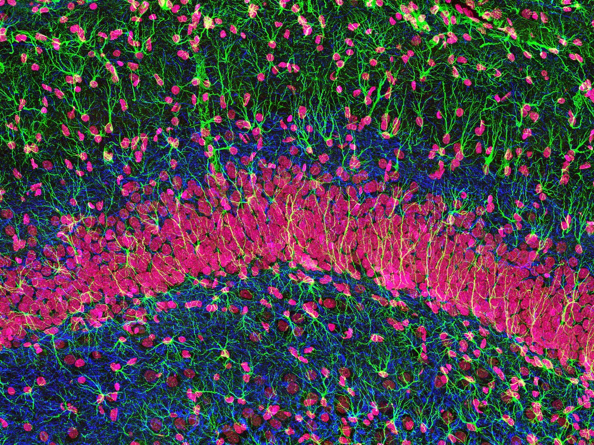 Scientists at @UCDAVISPharmac1 have decoded a mechanism in the nuclei of neurons that supports learning and the formation of memories in mice—helping to answer the mystery of how #GProteinCoupledReceptors facilitate memory consolidation. #Neuroscience scim.ag/2h7