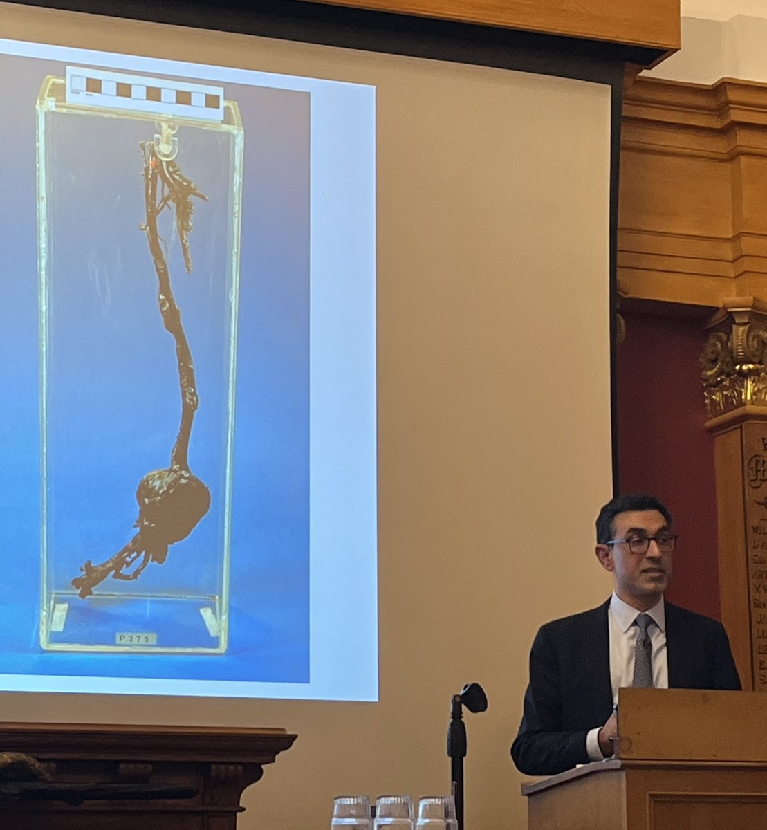 Wonderful talk by @b_modarai at the @HunterianSoc this evening on aortic aneurysms and the options for endovascular repair. Starting his talk with the popliteal aneurysms treated by John Hunter.