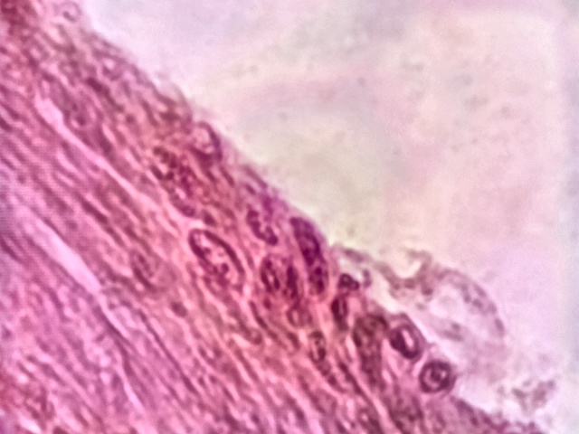 Take a look at the microscopic world with cellUview! 🔬 Our software makes it easy to do real time image analysis using the Openflexure microscope.  Check out these amazing images captured with our open source software. <a href="/OptoPhysAkhil/">Akhil Kallepalli .. on 🦋</a>  <a href="/KallepalliLab/">Kallepalli Lab .. on 🦋</a> <a href="/MarkMain_/">Mark Main</a>  @BerndPorr